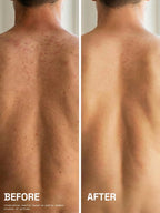 Before and after of a man's back showing cleared body acne after using PROWL Daily Body Wash Gel.