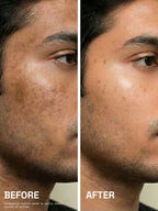 Before and after of a man's face showing brighter, even skin tone after using PROWL Daily Face Cream.
