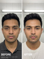 Before and after comparison of a man's face showing an improved, brighter, and more even skin tone after using PROWL Brightening Face Serum.