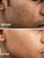 Before and after comparison of a man's cheek showing smoother, clearer skin after using PROWL Daily Face Wash.
