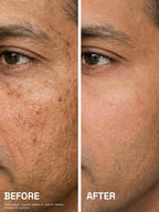 Before-and-after comparison of a man's cheek showing reduced dark spots and a more even skin tone after using PROWL Daily Sunscreen.